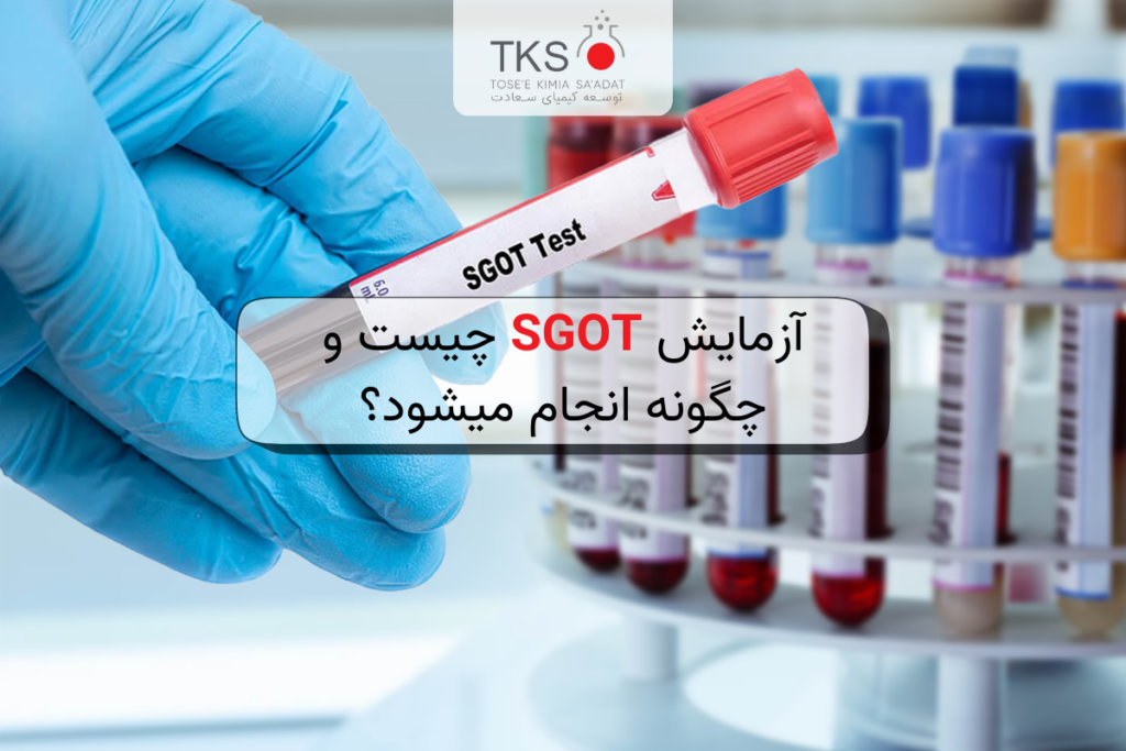 آزمایش SGOT چیست و چگونه انجام میشود؟