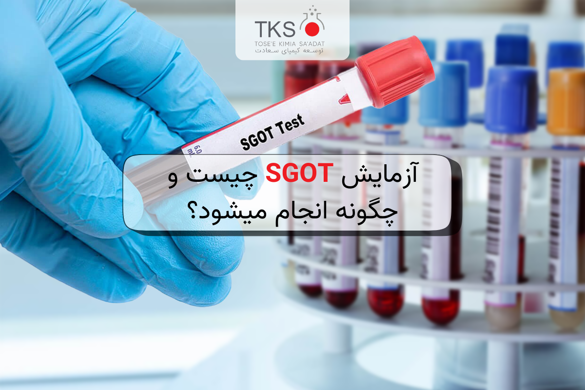 آزمایش SGOT چیست و چگونه انجام میشود؟