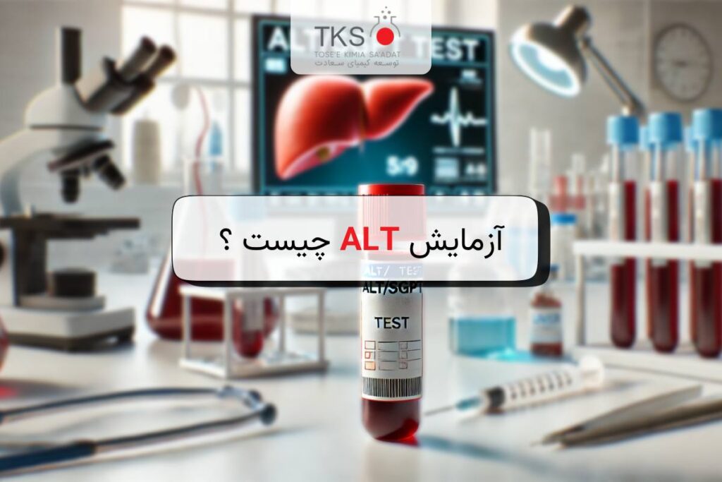 آزمایش ALT