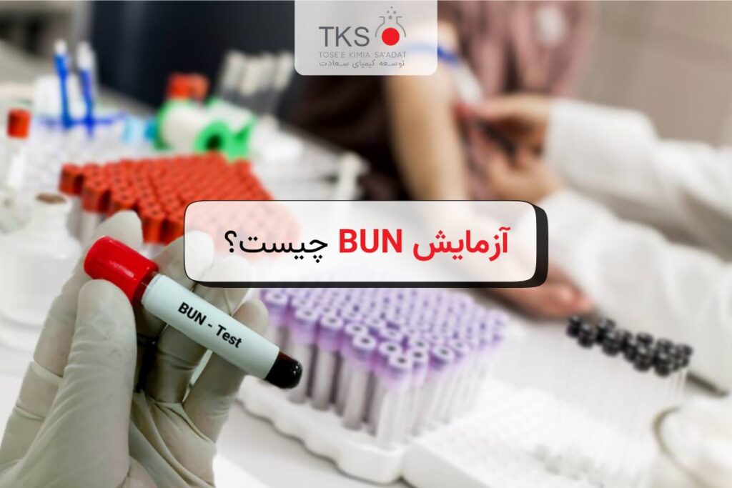 آزمایش BUN